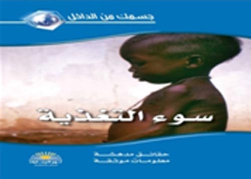 سوء التغذية